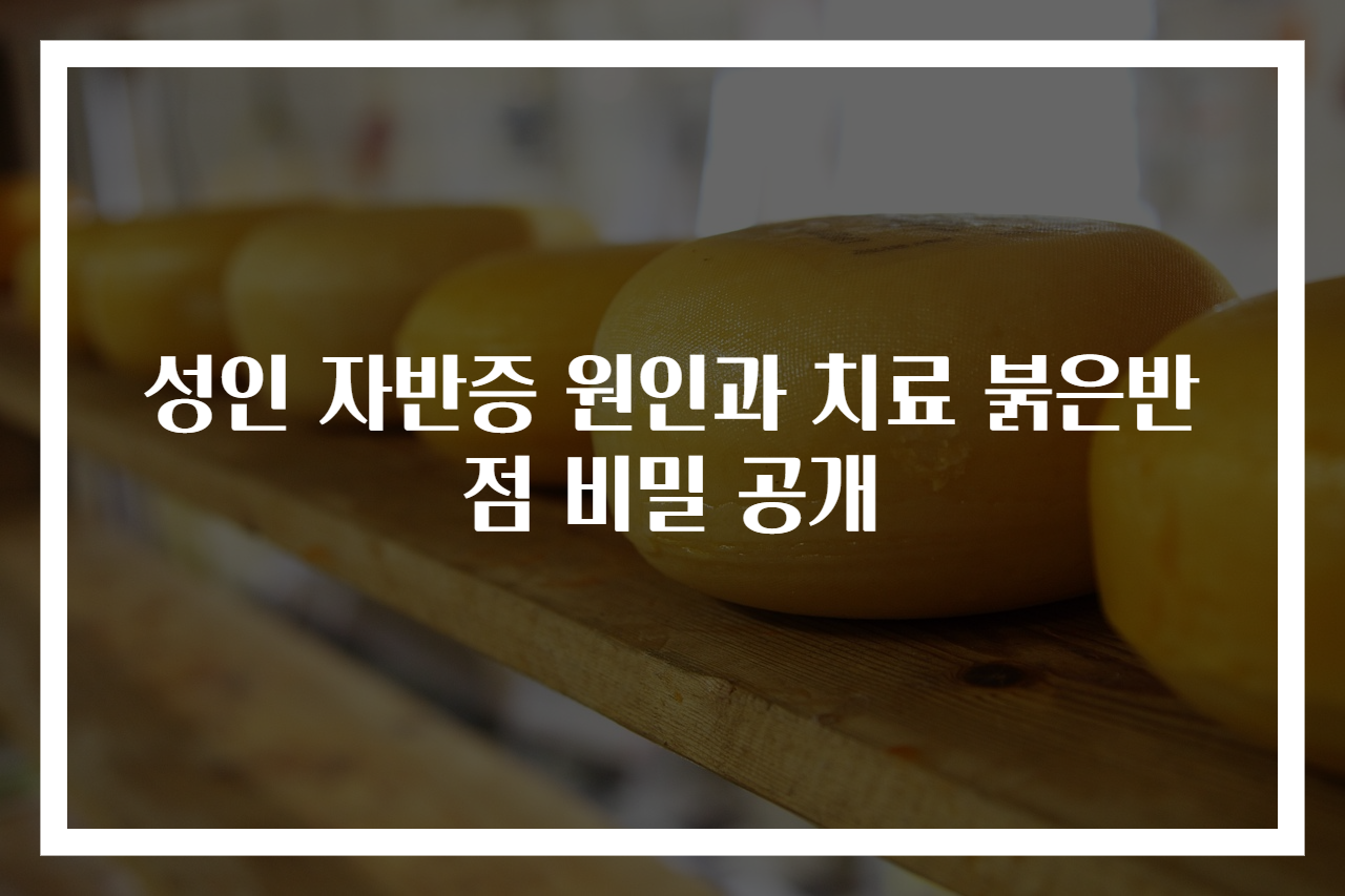 성인 자반증 원인과 치료 붉은반점 비밀 공개