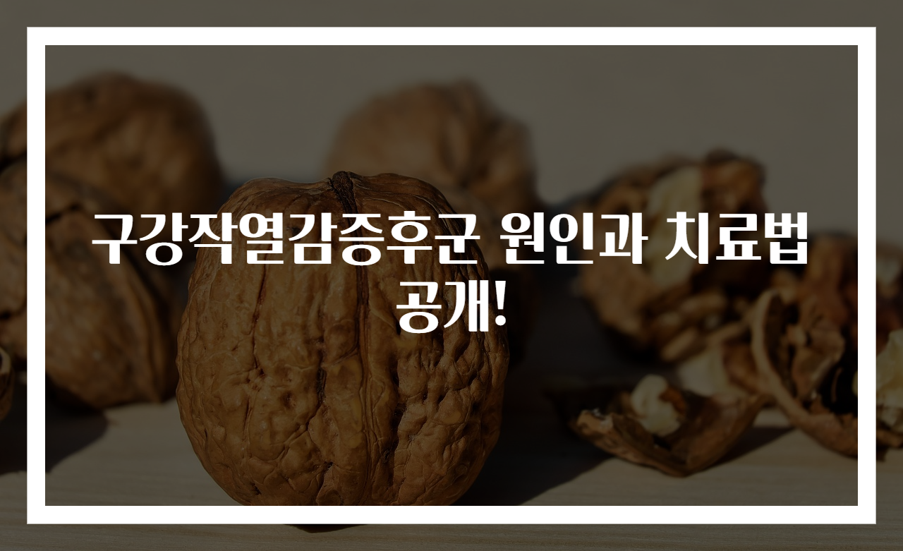 구강작열감증후군 원인과 치료법 공개!