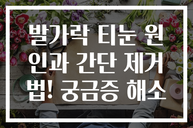 발가락 티눈 원인과 간단 제거법! 궁금증 해소