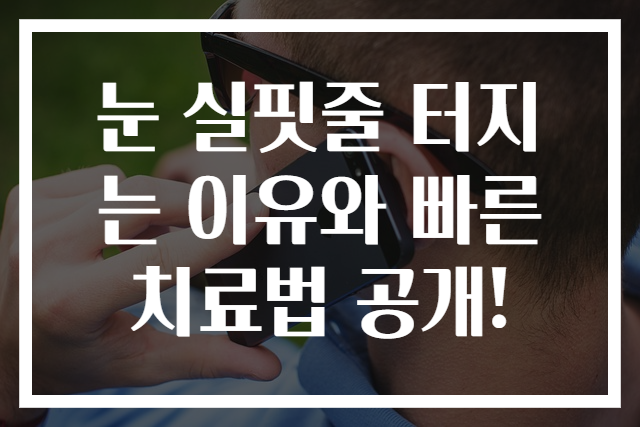 눈 실핏줄 터지는 이유와 빠른 치료법 공개!