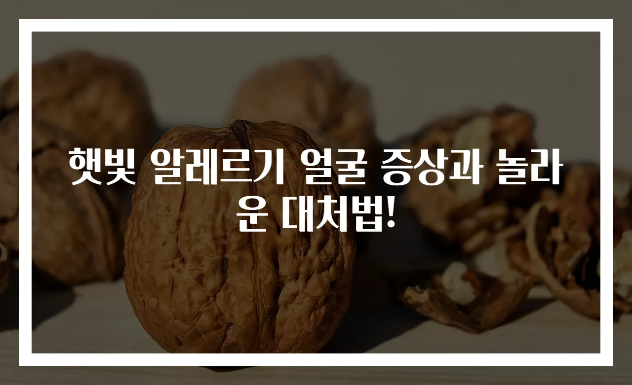 햇빛 알레르기 얼굴 증상과 놀라운 대처법!