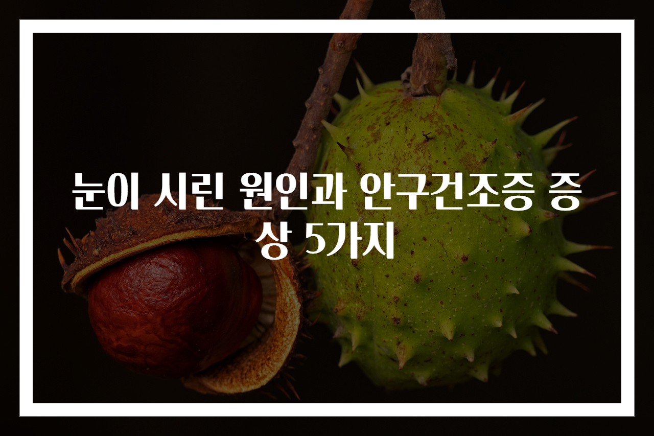 눈이 시린 원인과 안구건조증 증상 5가지
