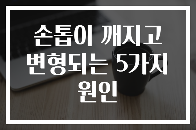 손톱이 깨지고 변형되는 5가지 원인